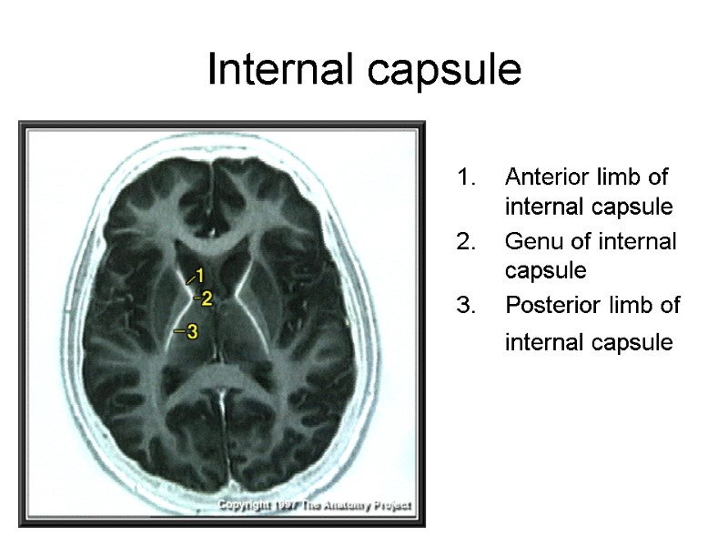 Internal capsule Anterior limb of internal capsule  Genu of internal capsule  Posterior